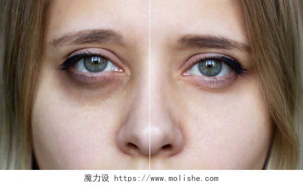 化妆与不化妆的区别用化妆品把年轻女性的脸剪下来的照片女性绿色眼睛，在化妆品治疗前后眼睛下方有瘀伤。黑眼圈下